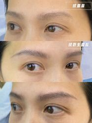 -OnFaer.纹眉半永久无创洗眉