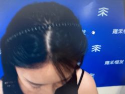 -雍禾植发全国连锁