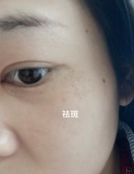 体验前-海峡医疗美容医院