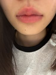 -广东韩妃整形外科医院
