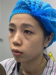 -天津健丽·去眼袋医疗美容机构