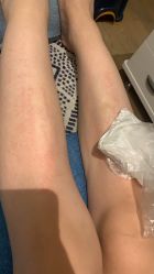 -深圳鹏爱悦心医疗美容医院