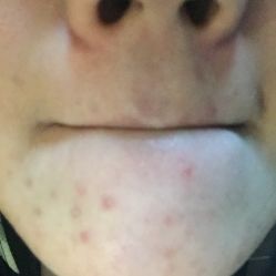 点击看大图 -MedSkinCare科技祛痘肌肤修护中心