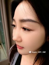 -安吉拉青春化管理中心