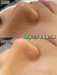 -安吉拉青春化管理中心