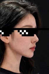 -天津健丽·去眼袋医疗美容机构