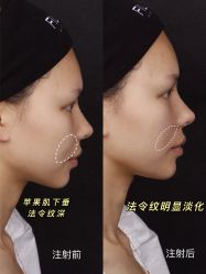 -上海玫瑰医疗美容医院