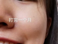 -东莞缔美美容医院