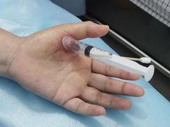 -广州市南沙区中医医院(珠江院区)