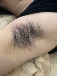 -薇兰专业脱毛连锁机构