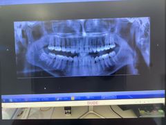 -土豆口腔(凤凰北总店)