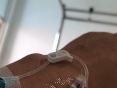 -北海市人民医院(总院)