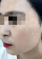 -北京美痣堂古方祛痣斑疣瘊