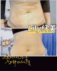 点击看大图 -Lily纤美·科技减脂中心