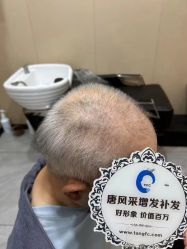 -唐风采假发补发定制