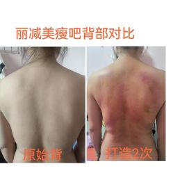 -丽减美瘦吧·减肥瘦身