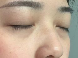 -北京米扬丽格医疗美容·联合丽格鼻整形中心