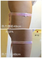光SPA热力塑瘦身-光SPA科技美肤