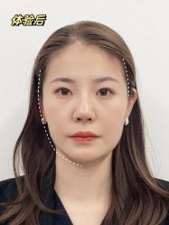 -Yestar艺星医疗美容医院