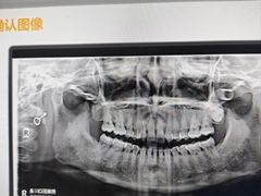 -圣贝口腔医院(高新院区)
