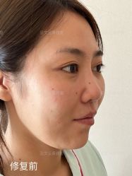 -北京米扬丽格医疗美容·联合丽格鼻整形中心