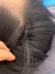 -熙朵美学植发·连锁品牌