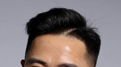 -大麦微针植发丨全国连锁