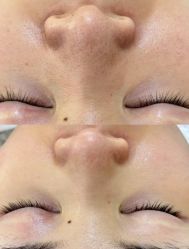 -美愈美肤MEIYU SKIN