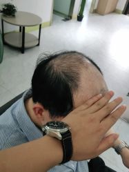 -发饰美男士增发补发假发定制店