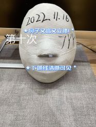 -小颜秘家·韩国整骨