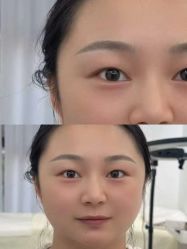 -张小野·专业半永久纹眉