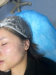 -长沙雅美医疗美容医院