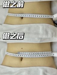 -Lily纤美·科技减脂中心