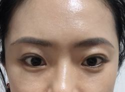 体验后-沈阳名流美容医院