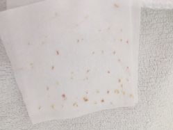 -苗方清颜专业祛痘连锁机构