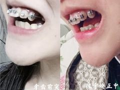 -团圆口腔·种植中心(锦江院区)