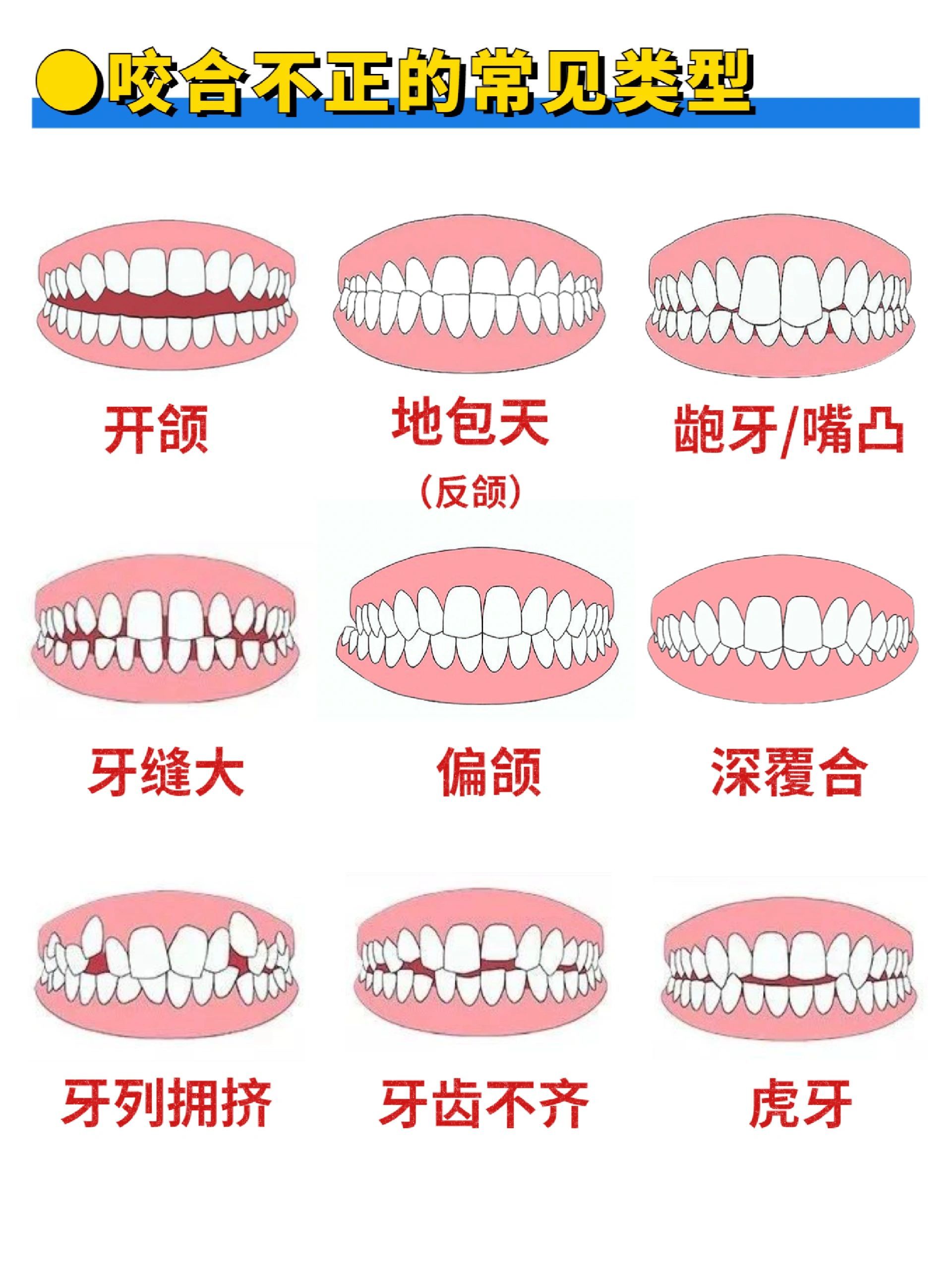 咬合不正竟然会影响体态?