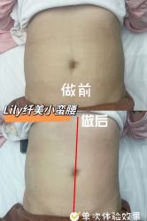 -Lily纤美·科技减脂中心