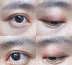 点击看大图 -安徽合肥韩美整形外科医院