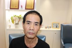 -大麦微针植发丨全国连锁