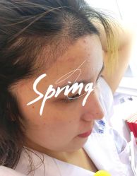 点击看大图 -大麦微针植发全国连锁