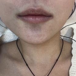 -Evigor医维格医美