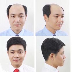 -发饰美男士增发补发假发定制店