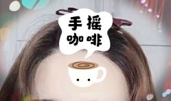 -大麦微针植发全国连锁