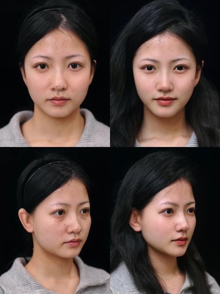 年前变美!do个妈生幼态脸