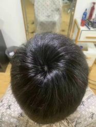 -靓康增发补发假发