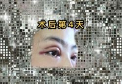 -南宁维密整形·王敦华眼鼻整复中心