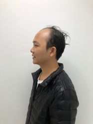 -发饰美男士增发补发假发定制店