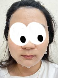 体验后-青岛诺德医学美容医院