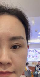 -长沙雅美医疗美容医院